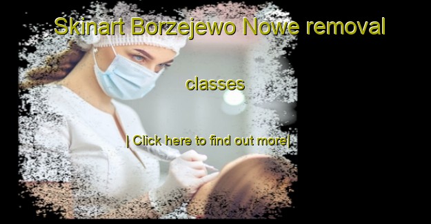 Skinart Borzejewo Nowe removal classes-United Kingdom