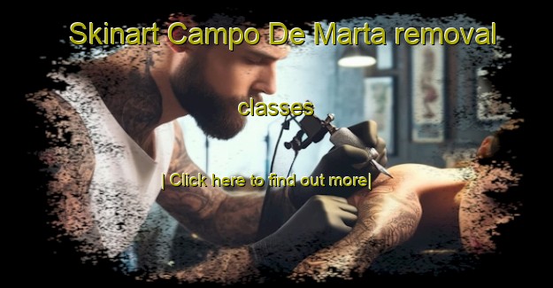 Skinart Campo De Marta removal classes-United Kingdom