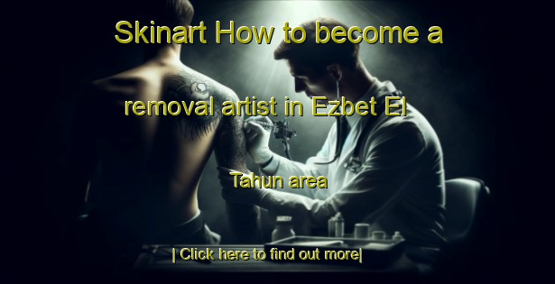 Skinart How to become a removal artist in Ezbet El Tahun area-United Kingdom