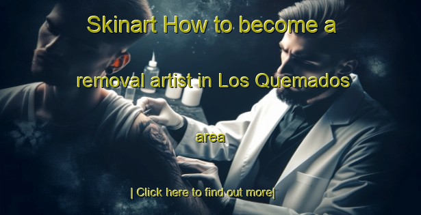 Skinart How to become a removal artist in Los Quemados area-United Kingdom