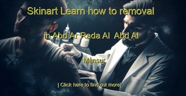 Skinart Learn how to removal in Abd Ar Rada Al  Abd Al Mansur-United Kingdom