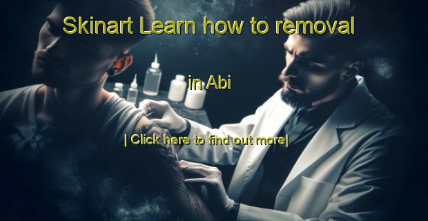 Skinart Learn how to removal in Abi-United Kingdom