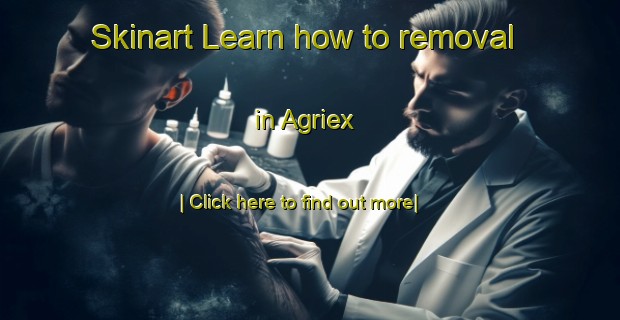 Skinart Learn how to removal in Agriex-United Kingdom