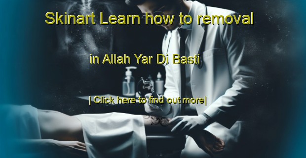 Skinart Learn how to removal in Allah Yar Di Basti-United Kingdom