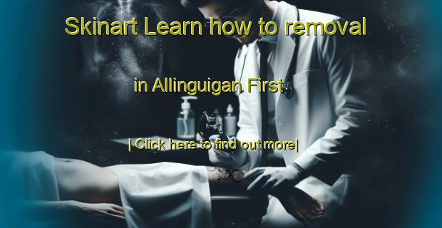 Skinart Learn how to removal in Allinguigan First-United Kingdom