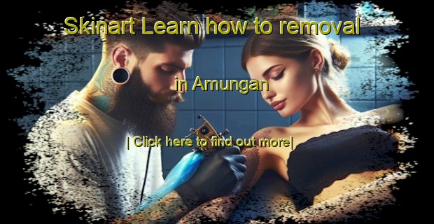 Skinart Learn how to removal in Amungan-United Kingdom