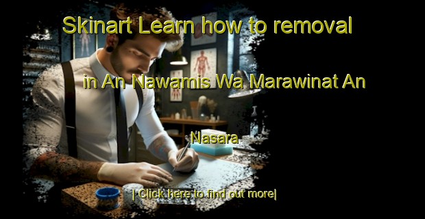 Skinart Learn how to removal in An Nawamis Wa Marawinat An Nasara-United Kingdom