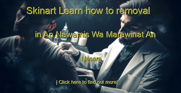 Skinart Learn how to removal in An Nawamis Wa Marawinat An Nasara-United Kingdom