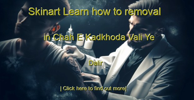 Skinart Learn how to removal in Chah E Kadkhoda Vali Ye Dalir-United Kingdom