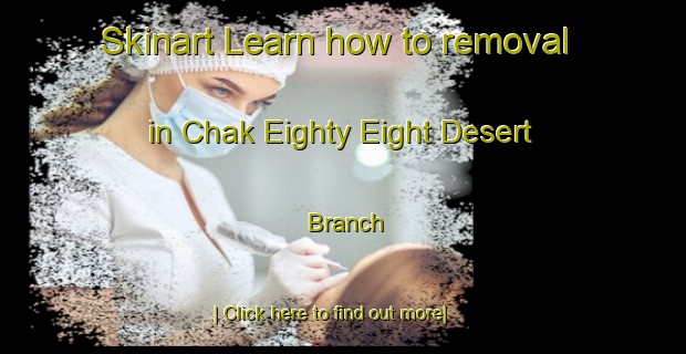 Skinart Learn how to removal in Chak Eighty Eight Desert Branch-United Kingdom