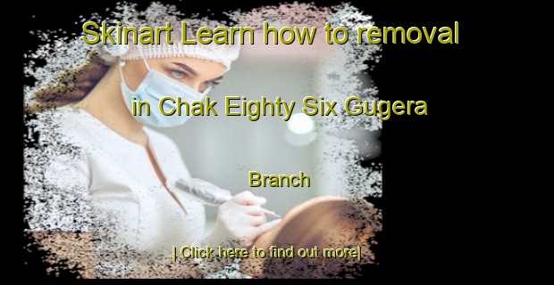 Skinart Learn how to removal in Chak Eighty Six Gugera Branch-United Kingdom