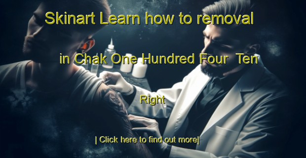 Skinart Learn how to removal in Chak One Hundred Four  Ten Right-United Kingdom