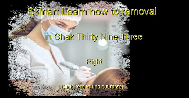 Skinart Learn how to removal in Chak Thirty Nine Three Right-United Kingdom