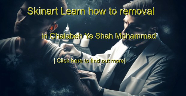 Skinart Learn how to removal in Chalabeh Ye Shah Mohammad-United Kingdom