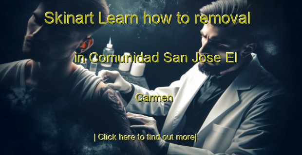 Skinart Learn how to removal in Comunidad San Jose El Carmen-United Kingdom