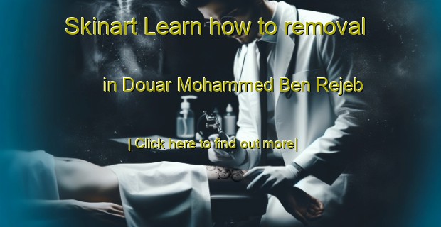 Skinart Learn how to removal in Douar Mohammed Ben Rejeb-United Kingdom