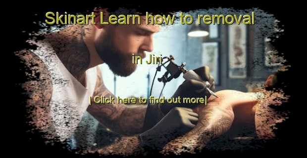 Skinart Learn how to removal in Jiri-United Kingdom