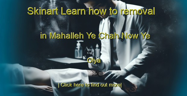 Skinart Learn how to removal in Mahalleh Ye Chah Now Ye  Olya-United Kingdom