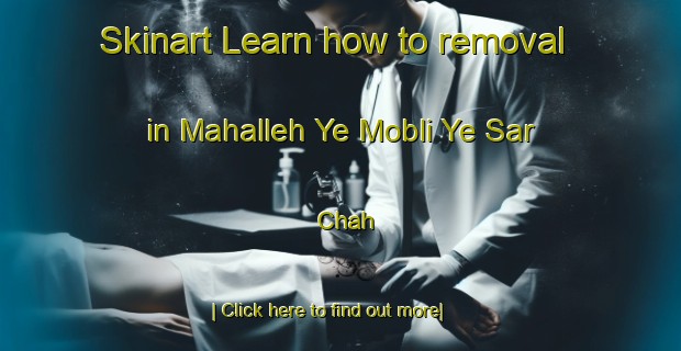 Skinart Learn how to removal in Mahalleh Ye Mobli Ye Sar Chah-United Kingdom