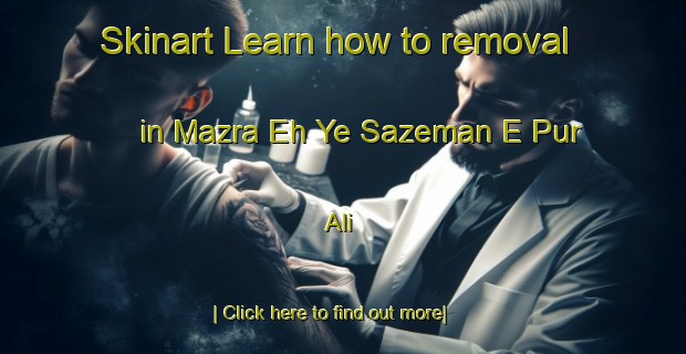 Skinart Learn how to removal in Mazra Eh Ye Sazeman E Pur Ali-United Kingdom