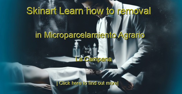 Skinart Learn how to removal in Microparcelamiento Agrario La Campana-United Kingdom