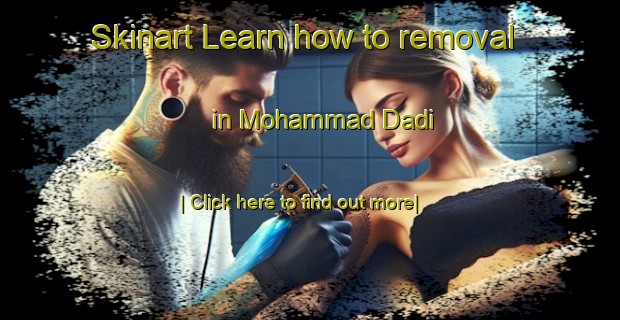 Skinart Learn how to removal in Mohammad Dadi-United Kingdom