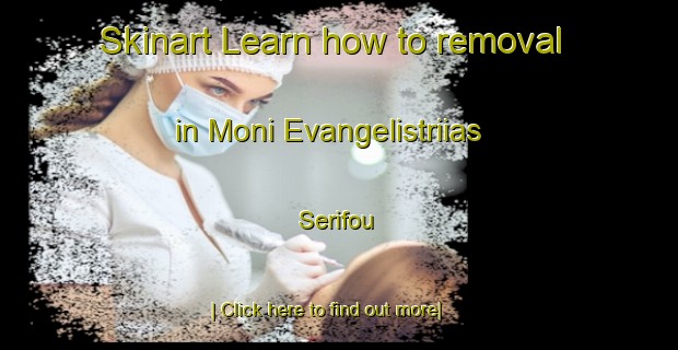 Skinart Learn how to removal in Moni Evangelistriias Serifou-United Kingdom