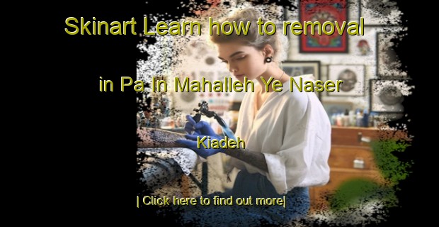 Skinart Learn how to removal in Pa In Mahalleh Ye Naser Kiadeh-United Kingdom