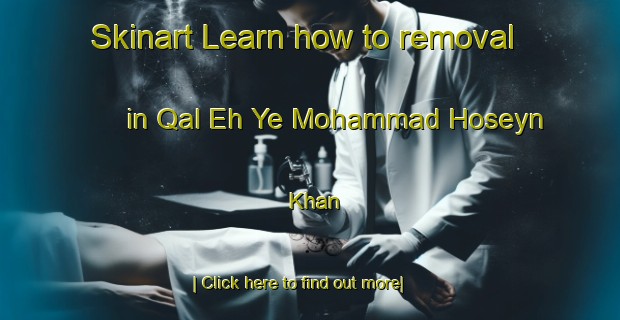 Skinart Learn how to removal in Qal Eh Ye Mohammad Hoseyn Khan-United Kingdom