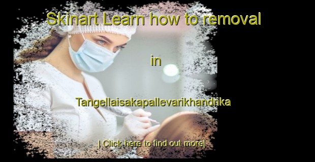 Skinart Learn how to removal in Tangellaisakapallevarikhandrika-United Kingdom