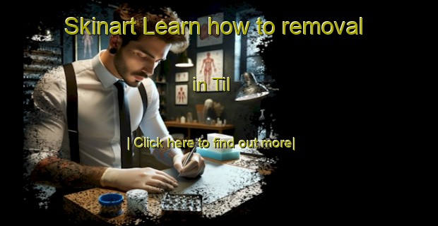 Skinart Learn how to removal in Til-United Kingdom