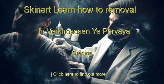 Skinart Learn how to removal in Verkhososen Ye Pervaya Sredina-United Kingdom