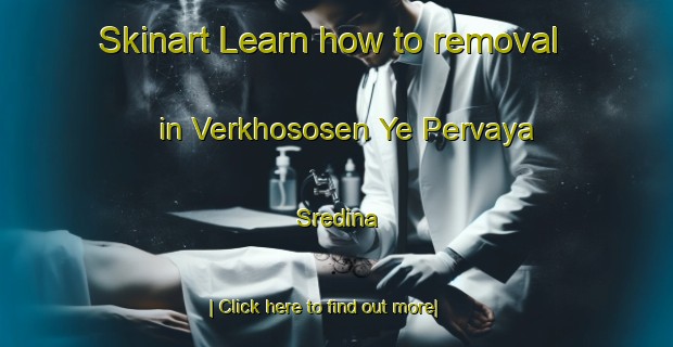 Skinart Learn how to removal in Verkhososen Ye Pervaya Sredina-United Kingdom