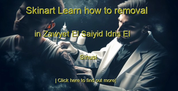 Skinart Learn how to removal in Zawyet El Saiyid Idris El  Sinusi-United Kingdom