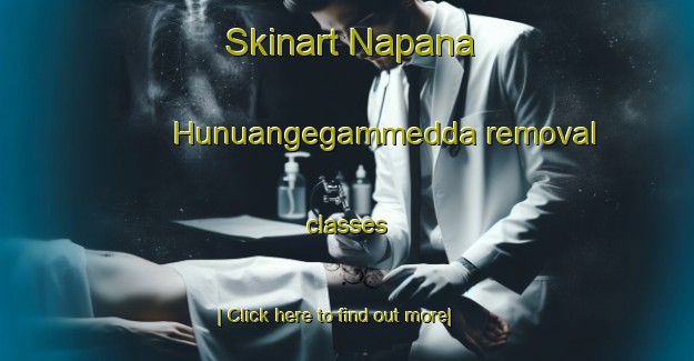 Skinart Napana Hunuangegammedda removal classes-United Kingdom