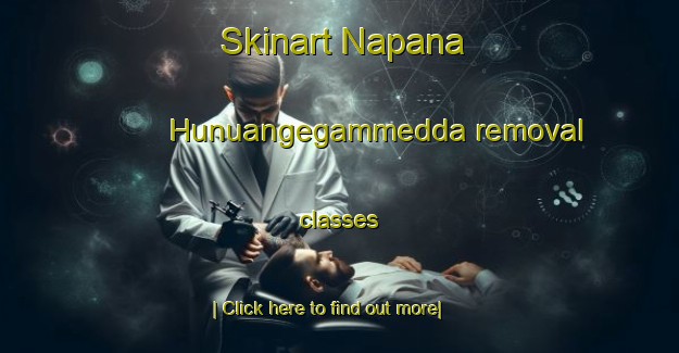 Skinart Napana Hunuangegammedda removal classes-United Kingdom