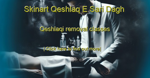 Skinart Qeshlaq E Sari Dagh Qeshlaqi removal classes-United Kingdom