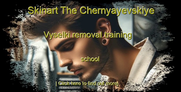 Skinart The Chernyayevskiye Vyselki removal training school-United Kingdom