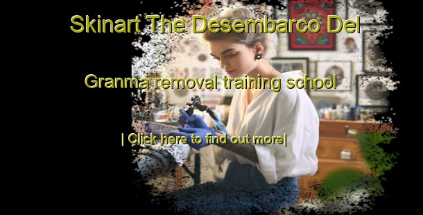 Skinart The Desembarco Del Granma removal training school-United Kingdom