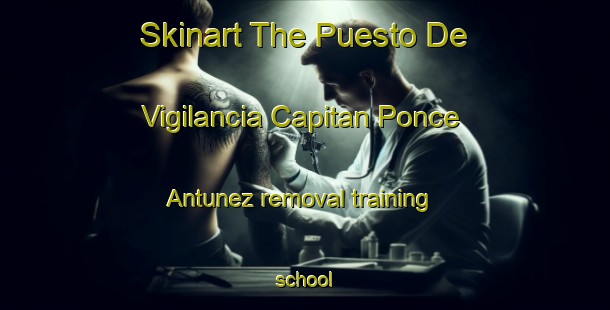 Skinart The Puesto De Vigilancia Capitan Ponce Antunez removal training school-United Kingdom