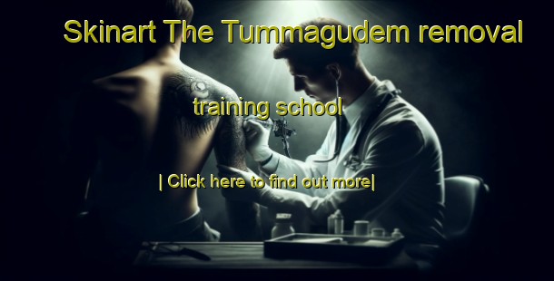 Skinart The Tummagudem removal training school-United Kingdom